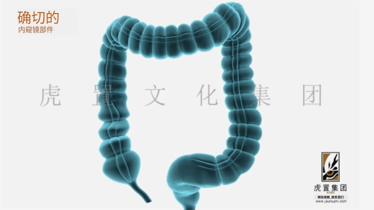 肠镜-1.jpg